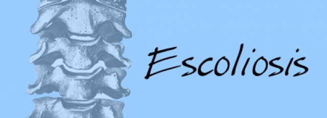 T_span_escoliosis1