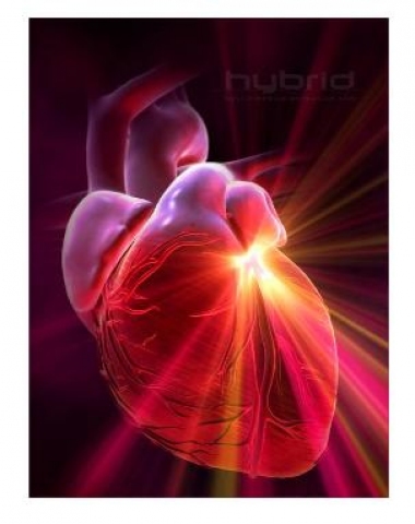 infarto-de-miocardio